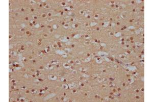 IHC image of ABIN7127821 diluted at 1:100 and staining in paraffin-embedded human brain tissue performed on a Leica BondTM system.