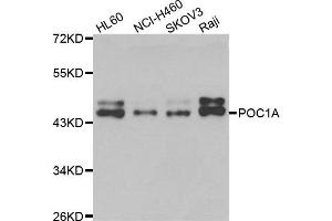Western blot analysis of extracts of various cell lines, using POC1A antibody. (POC1A Antikörper)