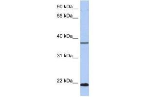 HDDC3 antibody used at 1 ug/ml to detect target protein. (HDDC3 Antikörper  (Middle Region))