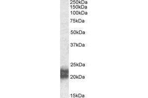 Western Blotting (WB) image for anti-Niemann-Pick Disease, Type C2 (NPC2) (AA 18-31) antibody (ABIN490668) (NPC2 Antikörper  (AA 18-31))