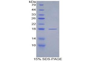 SDS-PAGE (SDS) image for Peroxiredoxin 2 (PRDX2) (AA 6-164) protein (His tag) (ABIN1877332)