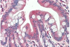 Human, Small intestine: Formalin-Fixed Paraffin-Embedded (FFPE) (TXNDC11 Antikörper  (AA 114-126))