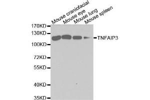 Western blot analysis of extracts of various cell lines, using TNFAIP3 antibody. (TNFAIP3 Antikörper  (AA 1-190))