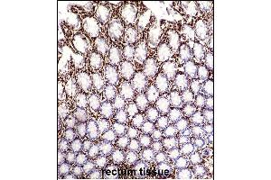 VIME Antibody (ABIN652639 and ABIN2842429) immunohistochemistry analysis in formalin fixed and paraffin embedded human rectum tissue followed by peroxidase conjugation of the secondary antibody and DAB staining. (Vimentin Antikörper)