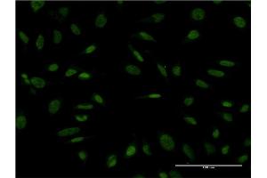 Immunofluorescence of monoclonal antibody to PROX1 on HeLa cell. (PROX1 Antikörper  (AA 638-737))