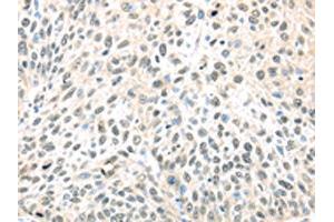 Immunohistochemistry (IHC) image for anti-Transcription Elongation Factor B (SIII), Polypeptide 1 (15kDa, Elongin C) (TCEB1) antibody (ABIN7128027)