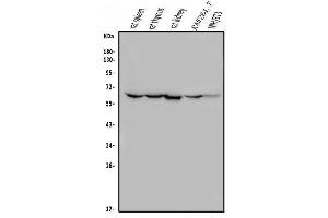Western blot analysis of ME2 using anti-ME2 antibody (ABIN7600967). (NAD-ME Antikörper  (AA 26-584))