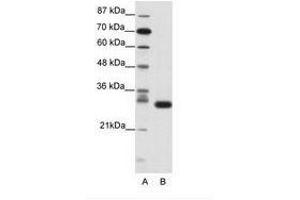 Image no. 1 for anti-Cyclin-Dependent Kinase 5 (CDK5) (N-Term) antibody (ABIN202178) (CDK5 Antikörper  (N-Term))