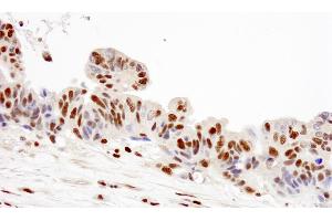 Immunohistochemistry (IHC) image for anti-Replication Protein A2, 32kDa (RPA2) (C-Term) antibody (ABIN7449012)