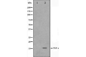 Western blot analysis on COS7 cell lysate using TGF alpha Antibody,The lane on the left is treated with the antigen-specific peptide. (TGFA Antikörper)