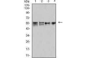 Western blot analysis using CD2 mouse mAb against MOLT4 (1), MCF-7 (2), Hela (3), and L1210 (4) cell lysate. (CD2 Antikörper  (AA 25-140))