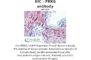 Image no. 2 for anti-PRKG antibody (ABIN1738352) (PRKG Antikörper)