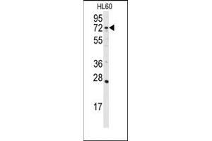 Image no. 1 for anti-Diacylglycerol Kinase, alpha 80kDa (DGKA) (C-Term) antibody (ABIN360612) (DGKA Antikörper  (C-Term))