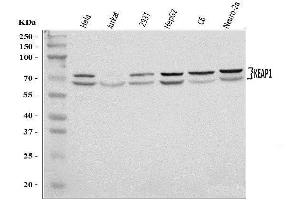 Western blot analysis of KEAP1 using anti-KEAP1 antibody (ABIN7602552).