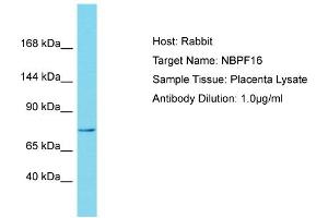 Host: Rabbit Target Name: NBPF15 Sample Tissue: Human Placenta Antibody Dilution: 1ug/ml (NBPF15 Antikörper  (N-Term))