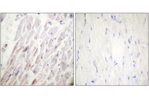 Immunohistochemistry analysis of paraffin-embedded human heart, using Dematin (Phospho-Ser403) Antibody. (Dematin Antikörper  (pSer403))