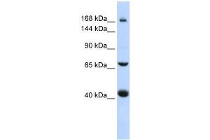 ABCC9 antibody used at 1 ug/ml to detect target protein. (ABCC9 Antikörper)