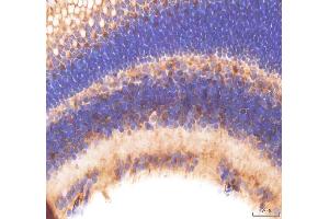anti-FERM and PDZ Domain Containing 4 (FRMPD4) antibody
