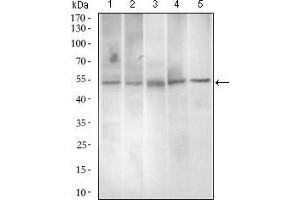 Western blot analysis using PAX3 mouse mAb against A549 (1), A431 (2), Jurkat (3), Rat spleen (4) and Mouse liver (5) cell lysate. (Paired Box 3 Antikörper  (AA 142-203))