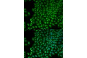 Immunofluorescence analysis of HeLa cells using POLR1C antibody. (POLR1C Antikörper)