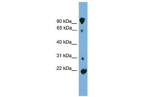 KLHL2 antibody used at 1 ug/ml to detect target protein. (KLHL2 Antikörper)