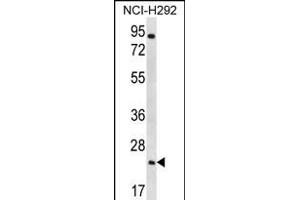 AQP5 Antibody (C-term) (ABIN656235 and ABIN2845551) western blot analysis in NCI- cell line lysates (35 μg/lane). (Aquaporin 5 Antikörper  (C-Term))