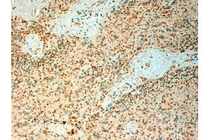 ABIN571057 (4µg/ml) staining of paraffin embedded Human Spleen. (TET2 Antikörper  (Internal Region))