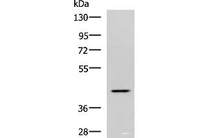 Western blot analysis of Hela cell lysate using SYT2 Polyclonal Antibody at dilution of 1:800 (SYT2 Antikörper)