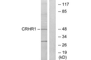 Western blot analysis of extracts from HT-29 cells, using CRHR1 antibody. (CRHR1 Antikörper  (Internal Region))