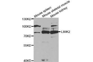 Western blot analysis of extracts of various cell lines, using LIMK2 antibody. (LIMK2 Antikörper  (AA 1-240))