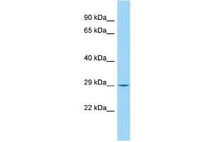 Host: Rabbit Target Name: CCDC134 Sample Type: Fetal Kidney lysates Antibody Dilution: 1. (CCDC134 Antikörper  (C-Term))