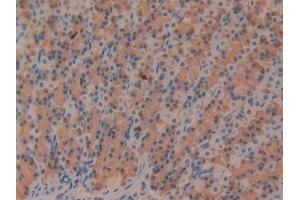 DAB staining on IHC-P; Samples: Rat Stomach Tissue (Fibrillin 1 Antikörper  (AA 1475-1638))