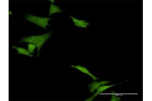 Immunofluorescence of purified MaxPab antibody to HABP4 on HeLa cell. (HABP4 Antikörper  (AA 1-308))