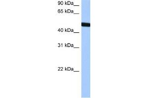 WB Suggested Anti-TBX20 Antibody Titration:  0. (TBX20 Antikörper  (Middle Region))