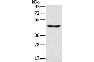 Western blot analysis of Human fetal brain tissue, using SLC16A8 Polyclonal Antibody at dilution of 1:200 (MCT3 Antikörper)