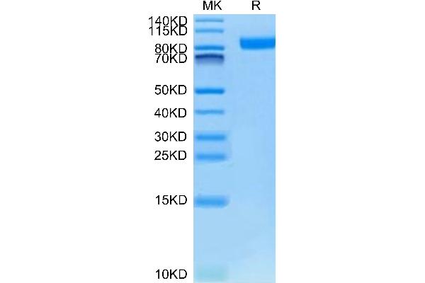 Neuropilin 1 Protein (NRP1) (AA 22-644) (His tag)