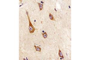 (ABIN652381 and ABIN2841827) staining TrkA in human brain tissue sections by Immunohistochemistry (IHC-P - paraformaldehyde-fixed, paraffin-embedded sections). (TrkA-pY791 (AA 769-796) Antikörper)