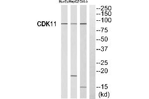 Western blot analysis of extracts from HUVEC cells, HepG2 cells and CoLo cells, using CDK11 antibody. (CDK11 Antikörper  (Internal Region))