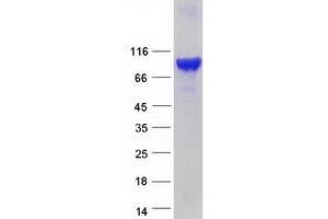 Validation with Western Blot (EPS8-Like 1 Protein (EPS8L1) (Transcript Variant 1) (Myc-DYKDDDDK Tag))