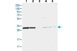 Western blot analysis of Lane 1: RT-4, Lane 2: U-251 MG, Lane 3: Human Plasma, Lane 4: Liver, Lane 5: Tonsil with TATDN1 polyclonal antibody . (TATDN1 Antikörper)