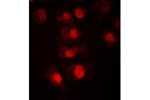 Immunofluorescent analysis of TCFL4 staining in LOVO cells. (MLX Antikörper  (Center))