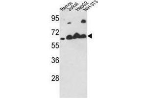 Image no. 1 for anti-Calreticulin (CALR) (Middle Region) antibody (ABIN452803) (Calreticulin Antikörper  (Middle Region))