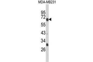 Western blot analysis of GIPR Antibody (Center) in MDA-MB231 cell line lysates (35ug/lane). (GIPR Antikörper  (Middle Region))
