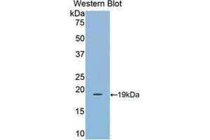 Western blot analysis of the recombinant protein. (LCAT Antikörper  (AA 290-434))
