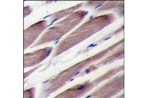 Formalin-fixed and paraffin-embedded human skeletal muscle tissue reacted with LATS2 antibody (Center), which was peroxidase-conjugated to the secondary antibody, followed by DAB staining. (LATS2 Antikörper  (Middle Region))