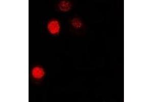 Immunofluorescent analysis of MATH-1 staining in U2OS cells. (ATOH1 Antikörper)