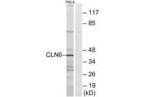 Western blot analysis of extracts from HeLa cells, using CLN6 antibody. (CLN6 Antikörper)