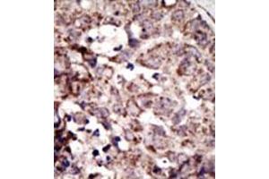 Image no. 2 for anti-Advanced Glycosylation End Product-Specific Receptor (AGER) (N-Term) antibody (ABIN357685)