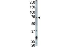Western Blotting (WB) image for anti-Signal Transducing Adaptor Molecule (SH3 Domain and ITAM Motif) 1 (STAM) antibody (ABIN3001494) (STAM Antikörper)
