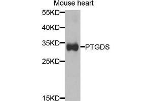 Western blot analysis of extracts of mouse heart, using PTGDS antibody. (PTGDS Antikörper)